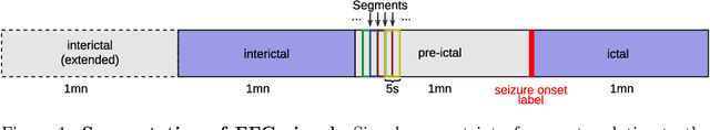 Figure 1 for Interpreting Deep Learning Models for Epileptic Seizure Detection on EEG signals
