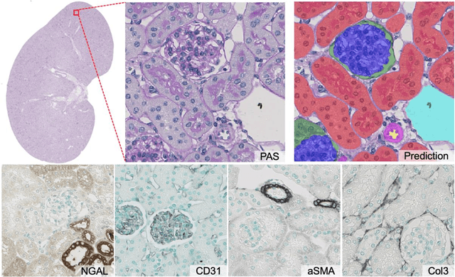 Figure 1 for Improving Unsupervised Stain-To-Stain Translation using Self-Supervision and Meta-Learning