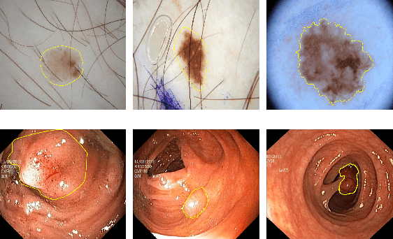 Figure 1 for Boundary-aware Context Neural Network for Medical Image Segmentation