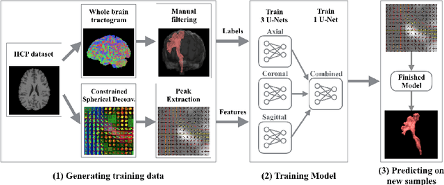 Figure 1 for Direct White Matter Bundle Segmentation using Stacked U-Nets