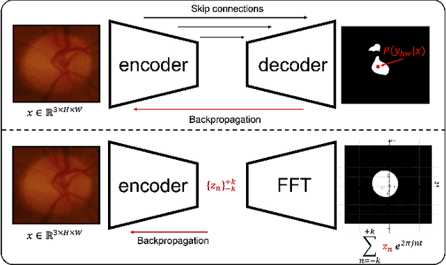 Figure 1 for FCSN: Global Context Aware Segmentation by Learning the Fourier Coefficients of Objects in Medical Images