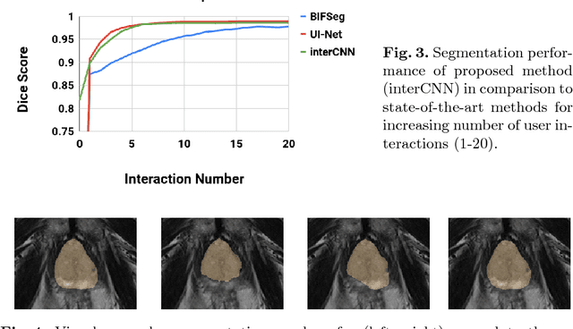 Figure 3 for Iterative Interaction Training for Segmentation Editing Networks