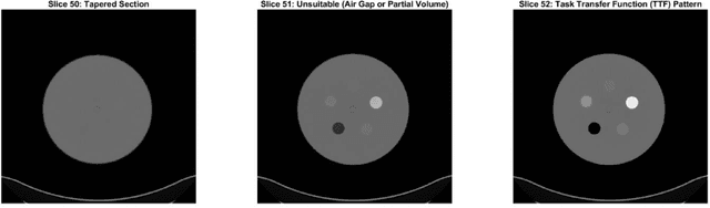 Figure 3 for Automatic phantom test pattern classification through transfer learning with deep neural networks