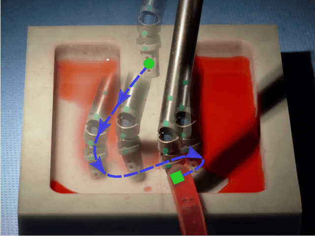 Figure 1 for Model-Predictive Control of Blood Suction for Surgical Hemostasis using Differentiable Fluid Simulations