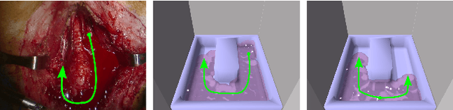 Figure 3 for Model-Predictive Control of Blood Suction for Surgical Hemostasis using Differentiable Fluid Simulations