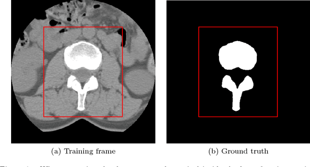 Figure 1 for Automatic Spine Segmentation using Convolutional Neural Network via Redundant Generation of Class Labels for 3D Spine Modeling