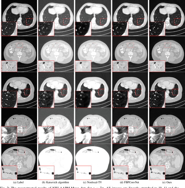 Figure 2 for A three-dimensional dual-domain deep network for high-pitch and sparse helical CT reconstruction