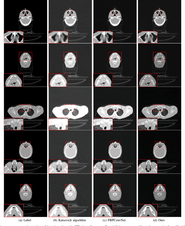 Figure 3 for A three-dimensional dual-domain deep network for high-pitch and sparse helical CT reconstruction