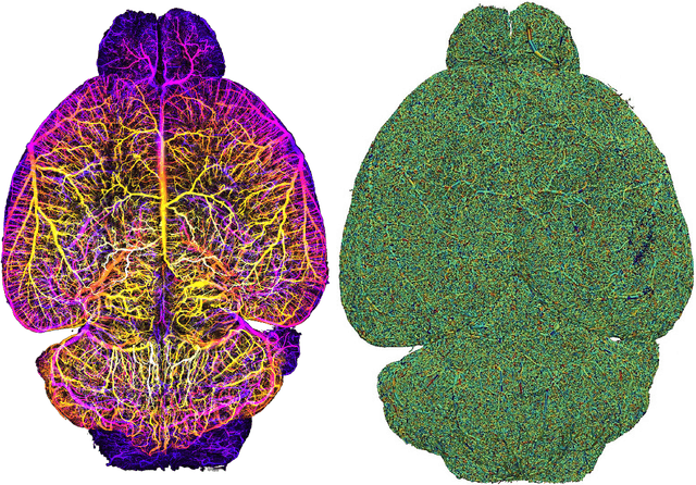 Figure 3 for Whole Brain Vessel Graphs: A Dataset and Benchmark for Graph Learning and Neuroscience