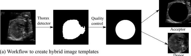 Figure 2 for Domain-guided data augmentation for deep learning on medical imaging