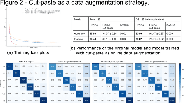 Figure 4 for Domain-guided data augmentation for deep learning on medical imaging