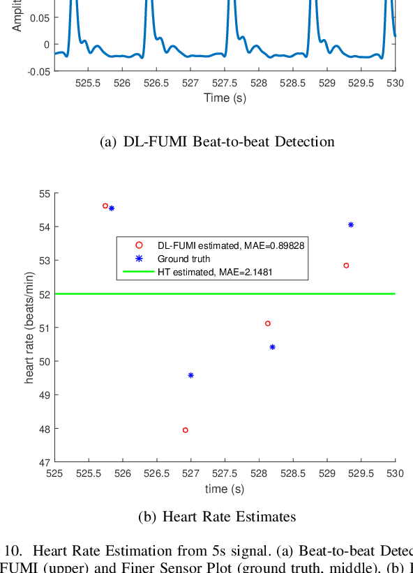Figure 2 for Multiple Instance Dictionary Learning for Beat-to-Beat Heart Rate Monitoring from Ballistocardiograms