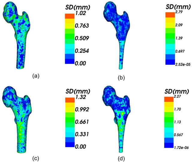 Figure 1 for A Deep Learning-Based Approach to Extracting Periosteal and Endosteal Contours of Proximal Femur in Quantitative CT Images