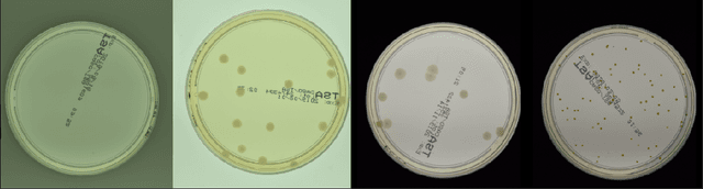 Figure 2 for Self-Normalized Density Map (SNDM) for Counting Microbiological Objects