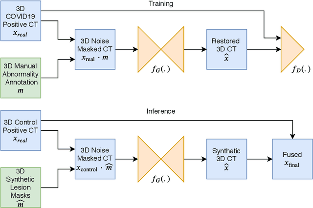Figure 1 for 3D Tomographic Pattern Synthesis for Enhancing the Quantification of COVID-19