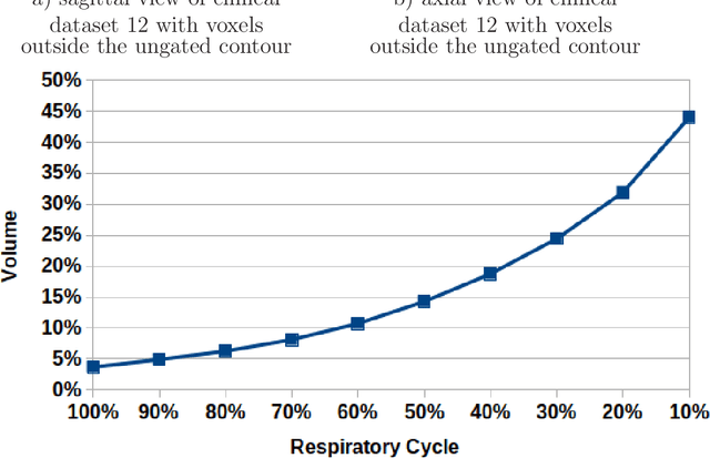 Figure 2 for Measuring breathing induced oesophageal motion and its dosimetric impact