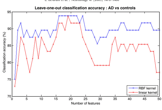 Figure 1 for Multidimensional classification of hippocampal shape features discriminates Alzheimer's disease and mild cognitive impairment from normal aging