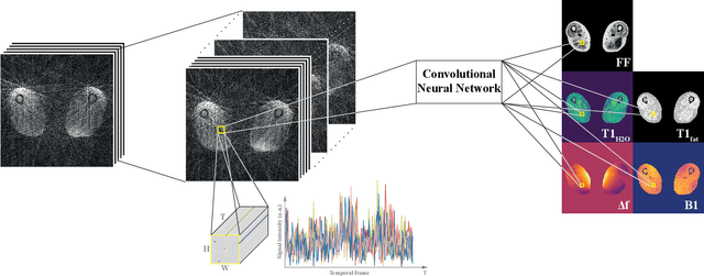 Figure 1 for Spatially Regularized Parametric Map Reconstruction for Fast Magnetic Resonance Fingerprinting