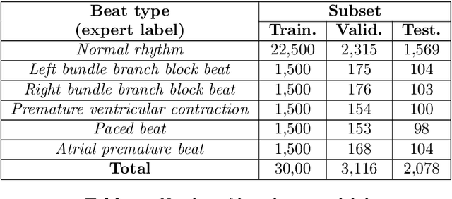 Figure 2 for Real-time ultra-low power ECG anomaly detection using an event-driven neuromorphic processor