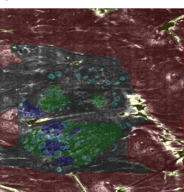 Figure 3 for Segmentation of Cellular Patterns in Confocal Images of Melanocytic Lesions in vivo via a Multiscale Encoder-Decoder Network (MED-Net)
