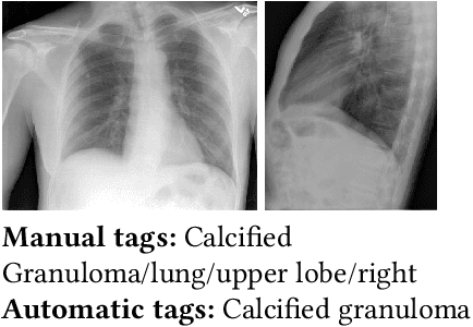 Figure 1 for A Survey on Deep Learning and Explainability for Automatic Image-based Medical Report Generation