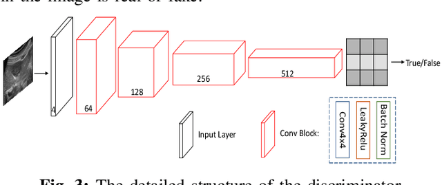 Figure 3 for Perception Consistency Ultrasound Image Super-resolution via Self-supervised CycleGAN