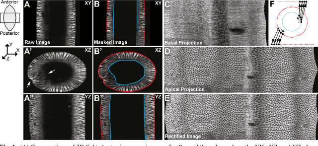 Figure 1 for Semi-Automatic Generation of Tight Binary Masks and Non-Convex Isosurfaces for Quantitative Analysis of 3D Biological Samples