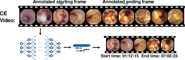 Figure 1 for Deep Transformers for Fast Small Intestine Grounding in Capsule Endoscope Video
