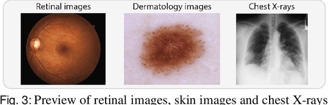 Figure 4 for Label-Efficient Self-Supervised Federated Learning for Tackling Data Heterogeneity in Medical Imaging