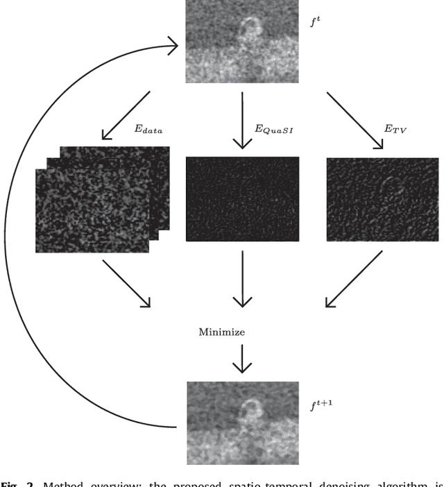 Figure 3 for Temporal and Volumetric Denoising via Quantile Sparse Image (QuaSI) Prior in Optical Coherence Tomography and Beyond
