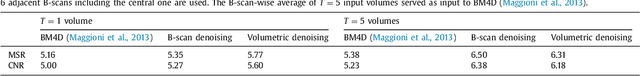 Figure 2 for Temporal and Volumetric Denoising via Quantile Sparse Image (QuaSI) Prior in Optical Coherence Tomography and Beyond