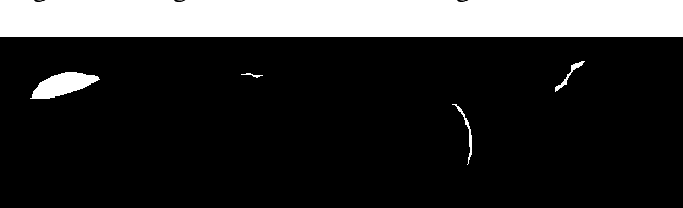 Figure 3 for A Graphical Approach For Brain Haemorrhage Segmentation