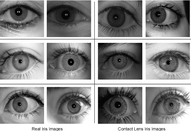 Figure 1 for Generalized Iris Presentation Attack Detection Algorithm under Cross-Database Settings