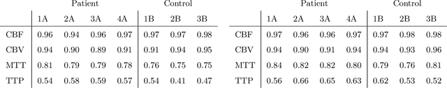 Figure 4 for Time separation technique with the basis of trigonometric functions as an efficient method for flat detector CT brain perfusion imaging