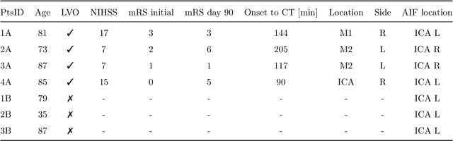 Figure 1 for Time separation technique with the basis of trigonometric functions as an efficient method for flat detector CT brain perfusion imaging