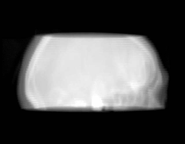 Figure 2 for Time separation technique with the basis of trigonometric functions as an efficient method for flat detector CT brain perfusion imaging