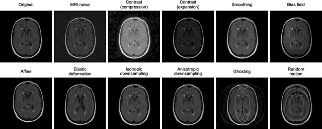 Figure 3 for ROOD-MRI: Benchmarking the robustness of deep learning segmentation models to out-of-distribution and corrupted data in MRI