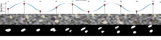 Figure 3 for In Search of Life: Learning from Synthetic Data to Detect Vital Signs in Videos