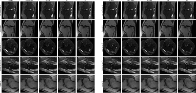 Figure 3 for Data consistency networks for (calibration-less) accelerated parallel MR image reconstruction