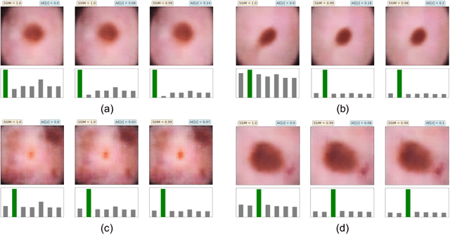 Figure 4 for Calibrating Healthcare AI: Towards Reliable and Interpretable Deep Predictive Models