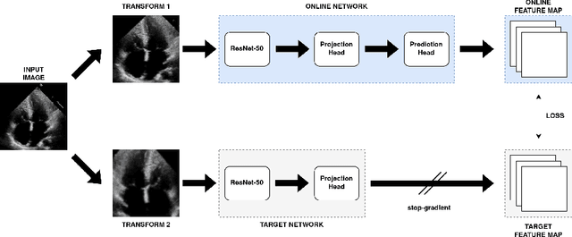 Figure 3 for Is Contrastive Learning Suitable for Left Ventricular Segmentation in Echocardiographic Images?