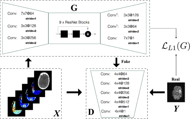 Figure 1 for CT-To-MR Conditional Generative Adversarial Networks for Ischemic Stroke Lesion Segmentation