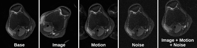 Figure 3 for VORTEX: Physics-Driven Data Augmentations for Consistency Training for Robust Accelerated MRI Reconstruction