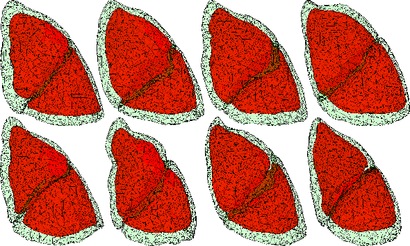Figure 2 for Kernel-based framework to estimate deformations of pneumothorax lung using relative position of anatomical landmarks