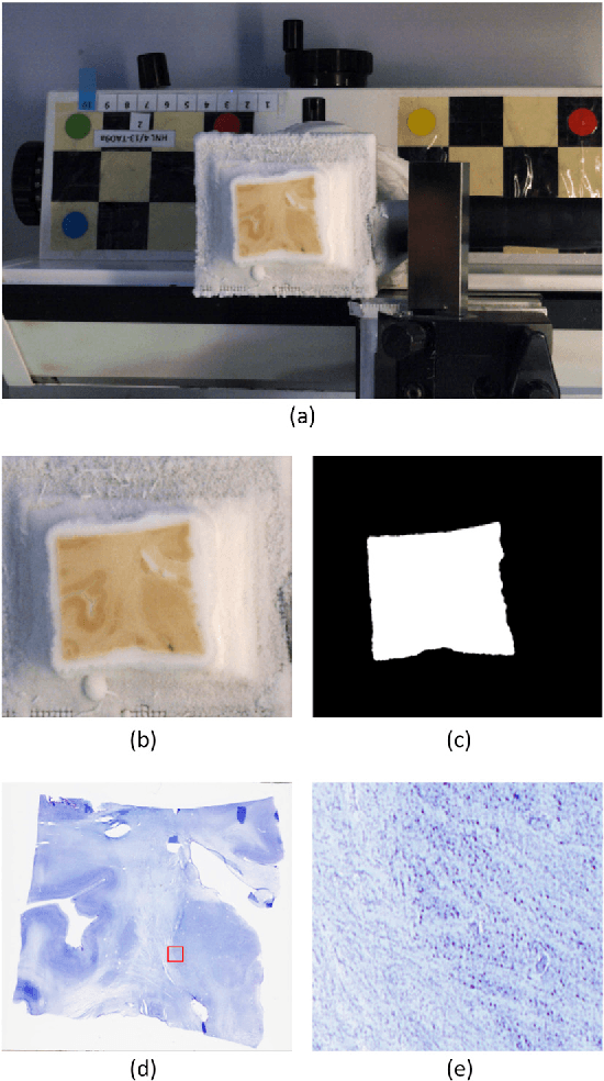Figure 3 for A probabilistic atlas of the human thalamic nuclei combining ex vivo MRI and histology