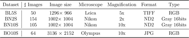 Figure 1 for Neural Style Transfer and Unpaired Image-to-Image Translation to deal with the Domain Shift Problem on Spheroid Segmentation