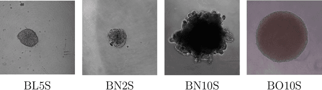 Figure 2 for Neural Style Transfer and Unpaired Image-to-Image Translation to deal with the Domain Shift Problem on Spheroid Segmentation