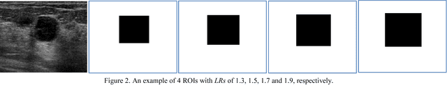Figure 3 for A Benchmark for Breast Ultrasound Image Segmentation (BUSIS)