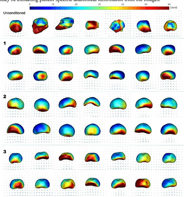 Figure 4 for Intraoperative Organ Motion Models with an Ensemble of Conditional Generative Adversarial Networks