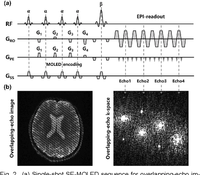 Figure 2 for Model-based Synthetic Data-driven Learning (MOST-DL): Application in Single-shot T2 Mapping with Severe Head Motion Using Overlapping-echo Acquisition